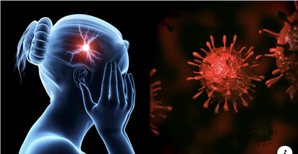 Flu Brain: Here’s What the Virus Does to Your Central Nervous System