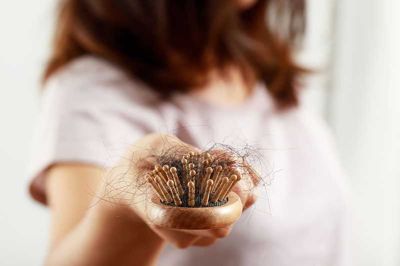 Which nutritional supplements are best for treating hair loss?